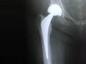 ortho clinic chennai