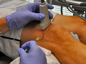 ortho treatment chennai