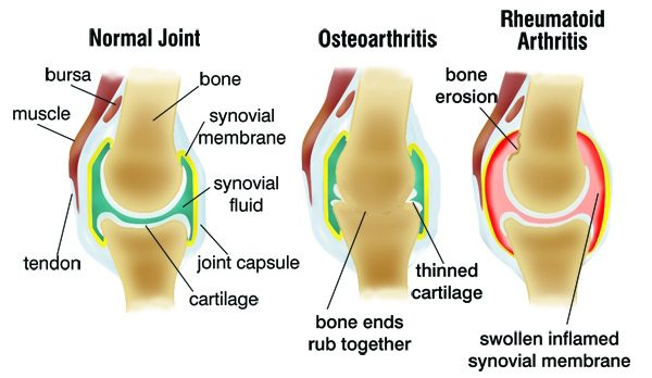 Best arthritis doctor